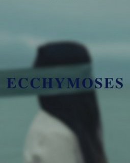 Ecchymoses - Carelle D