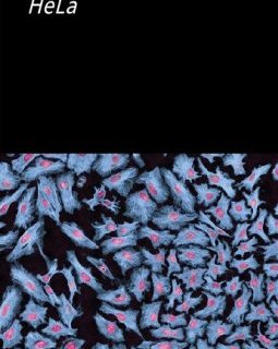 HeLa - Aléinor Debrocq