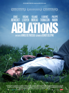 Ablations - Arnold de Parscau